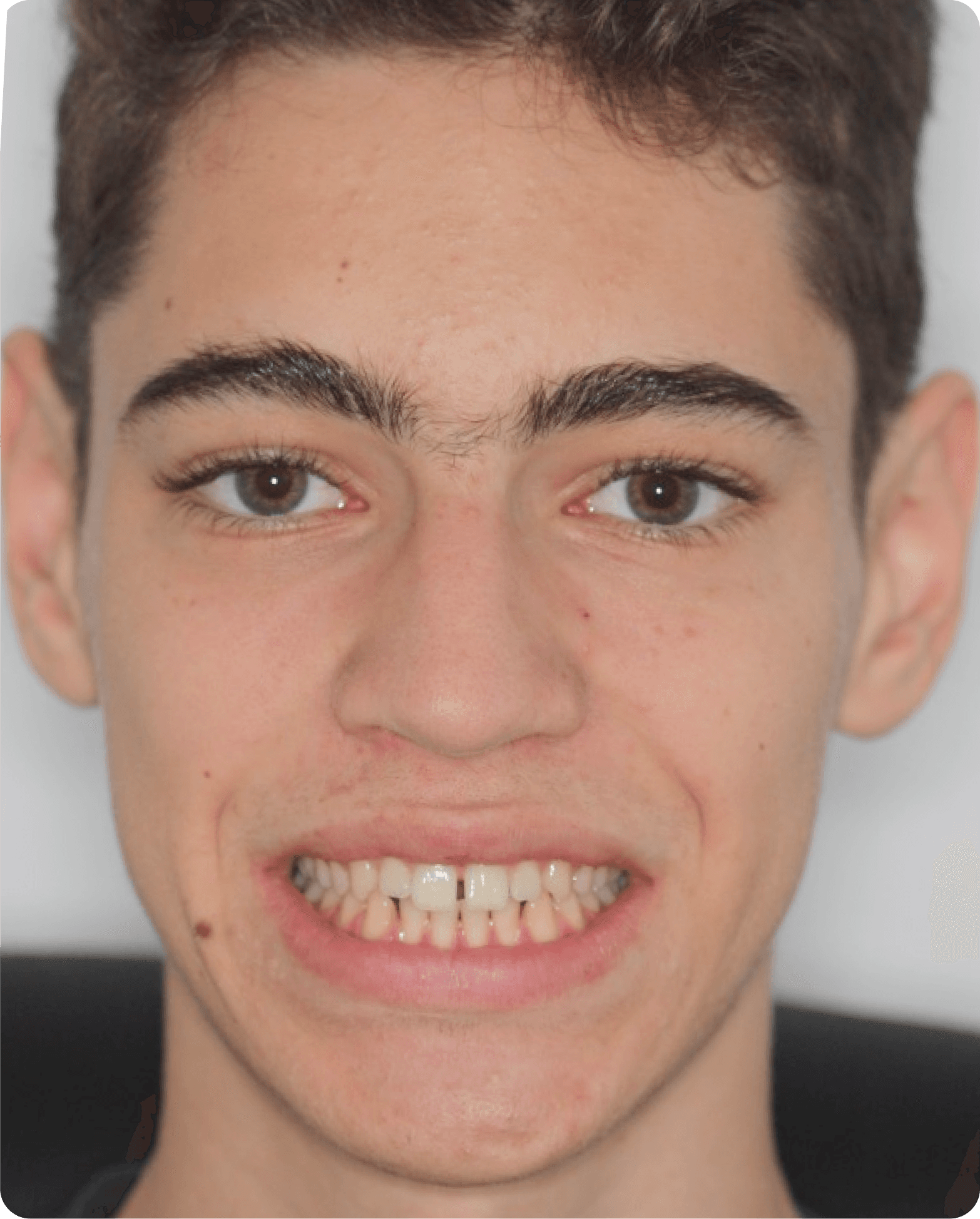 Matic prej